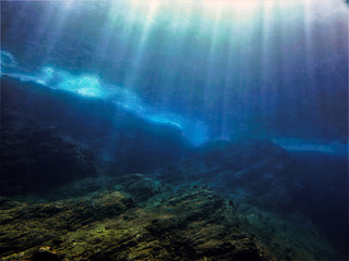 幼儿园保育员技能考试的考试试题是什么？